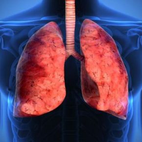 Cancro al polmone: ecco il nuovo e portentoso farmaco