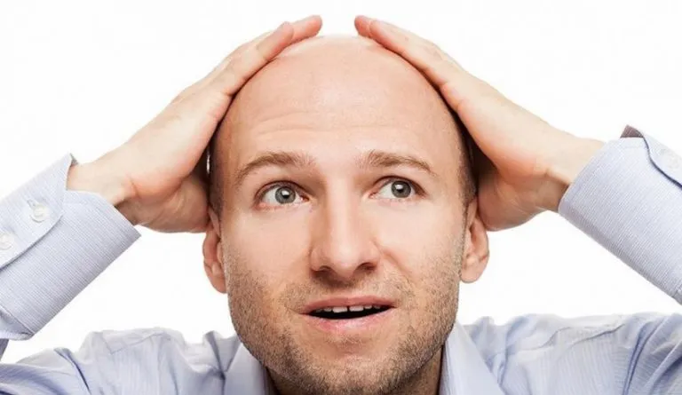 Calvizie news: mele annurche contro la caduta dei capelli