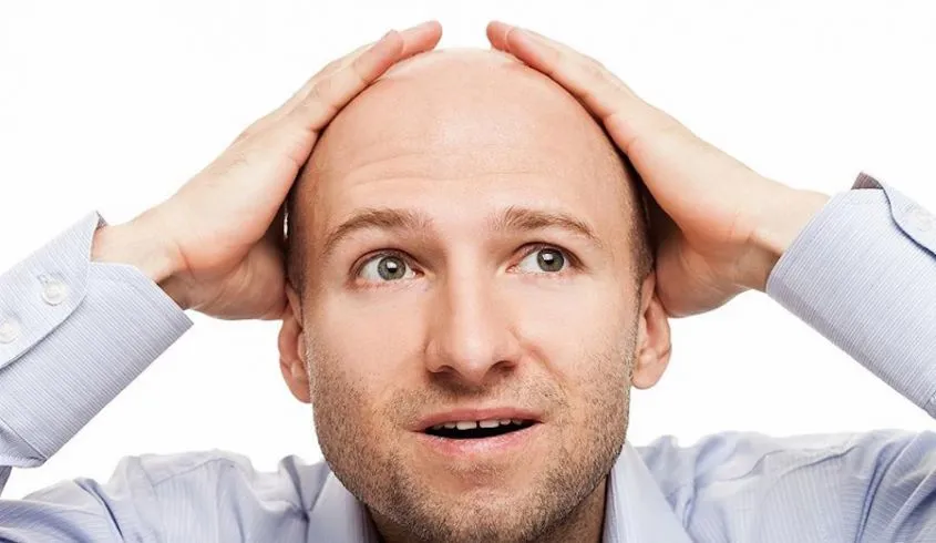 Calvizie news: mele annurche contro la caduta dei capelli
