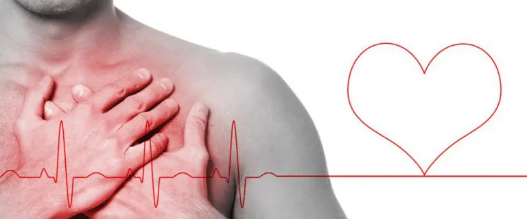 Infarto e ictus: attenzione alle onde che li provocano