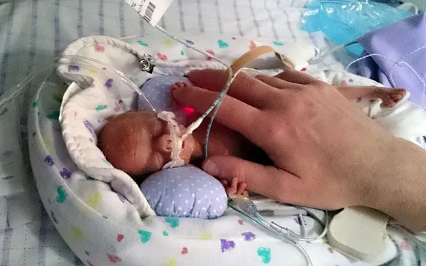 Giornata Mondiale della Prematurità: bisogna migliorare assistenza neonatale nel Paese