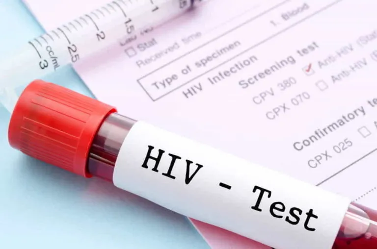 Lotta all’Aids, minorenni potranno sottoporsi al Test Hiv senza il consenso dei genitori