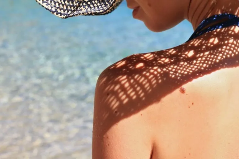 Cancro in estate: le cinque regole per affrontare al meglio il melanoma